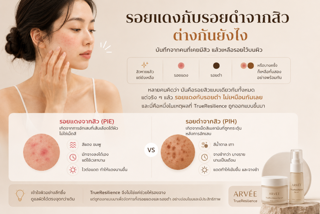 รอยแดงและรอยดำจากสิวเกิดจากกลไกคนละแบบ รอยแดงมาจากหลอดเลือดที่ยังฟื้นตัวไม่เสร็จ ส่วนรอยดำมาจากเม็ดสีผิวที่สร้างเพิ่มขึ้น